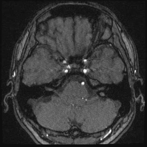 Click on the Serie image to view the images of VILLANUEVA, WILLIAM A.